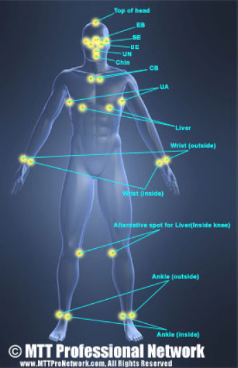 MTT Tapping Points